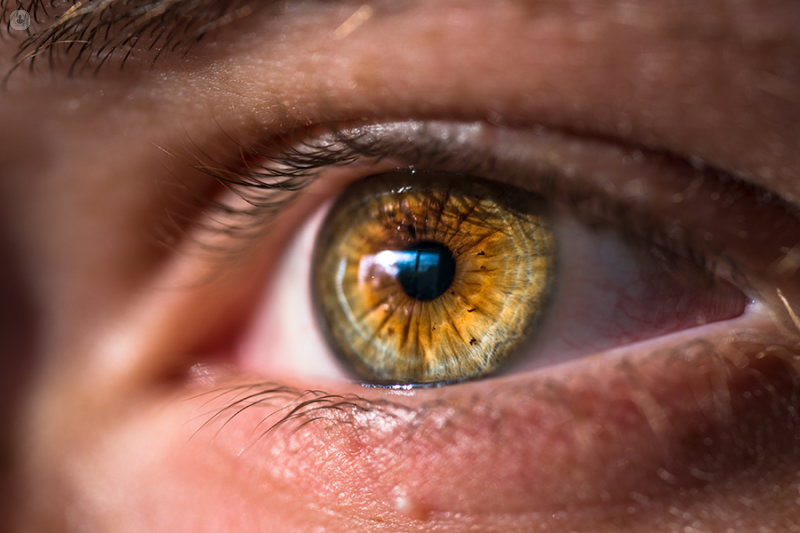 Implantable Contact Lenses